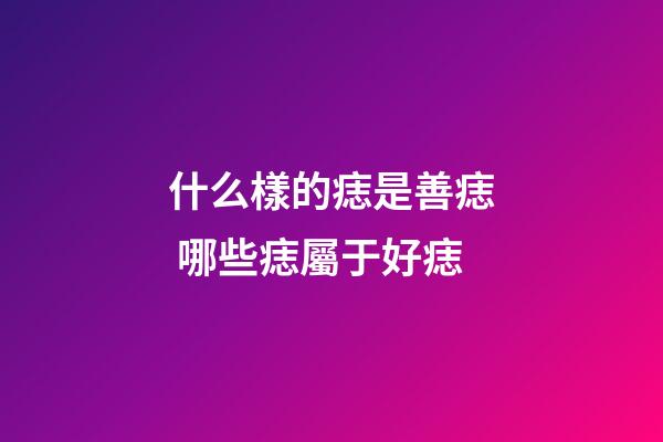 什么樣的痣是善痣 哪些痣屬于好痣